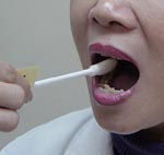 福州亲子鉴定口腔黏膜采集2